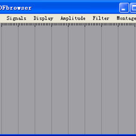 EDFbrowser(EDF����༭��)